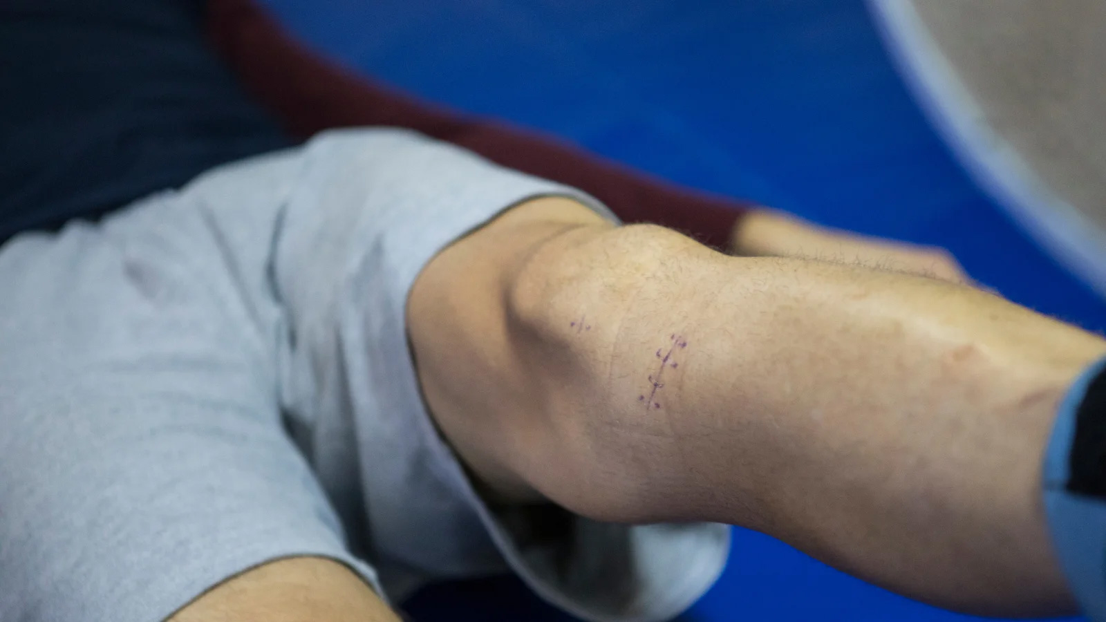 Knee and ACL Injuries